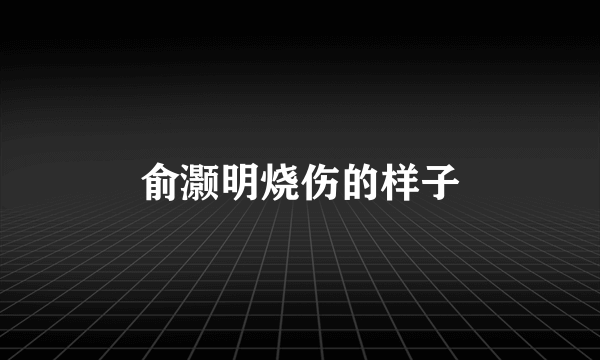 俞灏明烧伤的样子